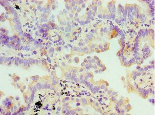 FDFT1 Antibody