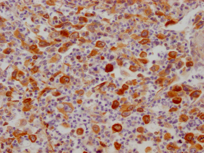 FDFT1 Antibody