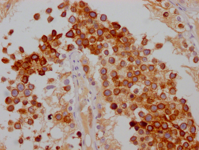 FDFT1 Antibody