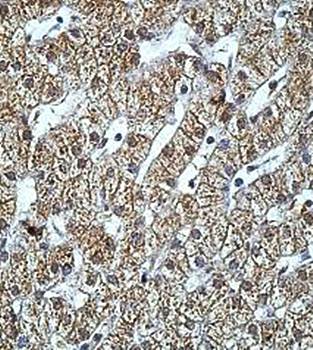 FDXR Rabbit Polyclonal Antibody