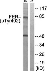 FER (Phospho-Tyr402) Antibody