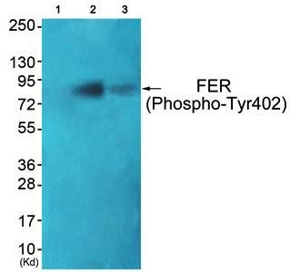 FER (Phospho-Tyr402) Antibody