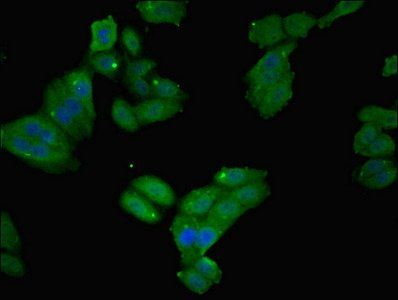 FTL Antibody