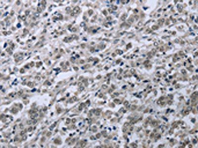 FES Antibody