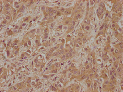 FGFR2 Antibody