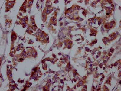FGFR4 Antibody