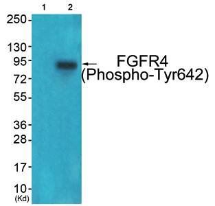 FGFR4 (Phospho-Tyr642) Antibody
