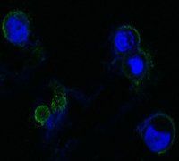 FGFR4 Antibody