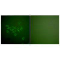 FHIT Antibody