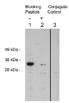 Rabbit Human FHL2 Antibody