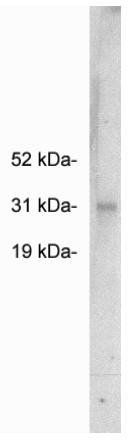 Rabbit Human FHL2 Antibody