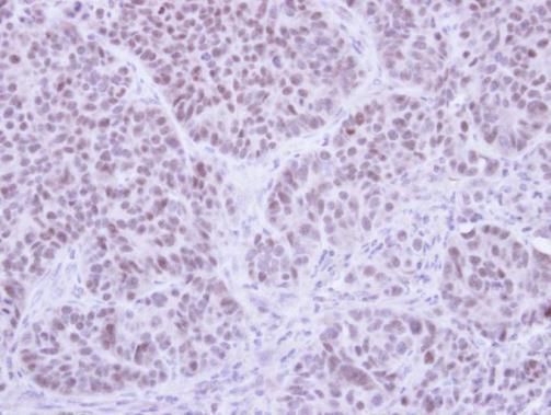 four and a half LIM domains 5 Antibody