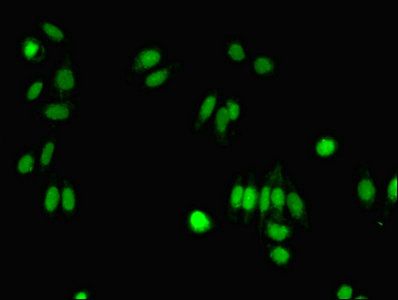FIBP Antibody
