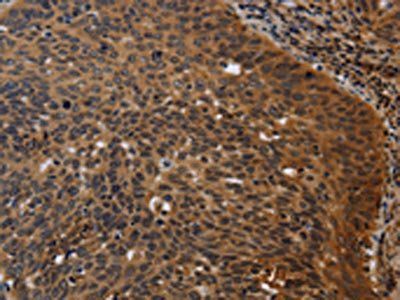 FGB Antibody