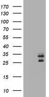 Fibrinogen gamma chain Antibody
