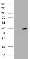 Fibrinogen gamma chain Antibody