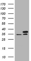 Fibrinogen gamma chain Antibody