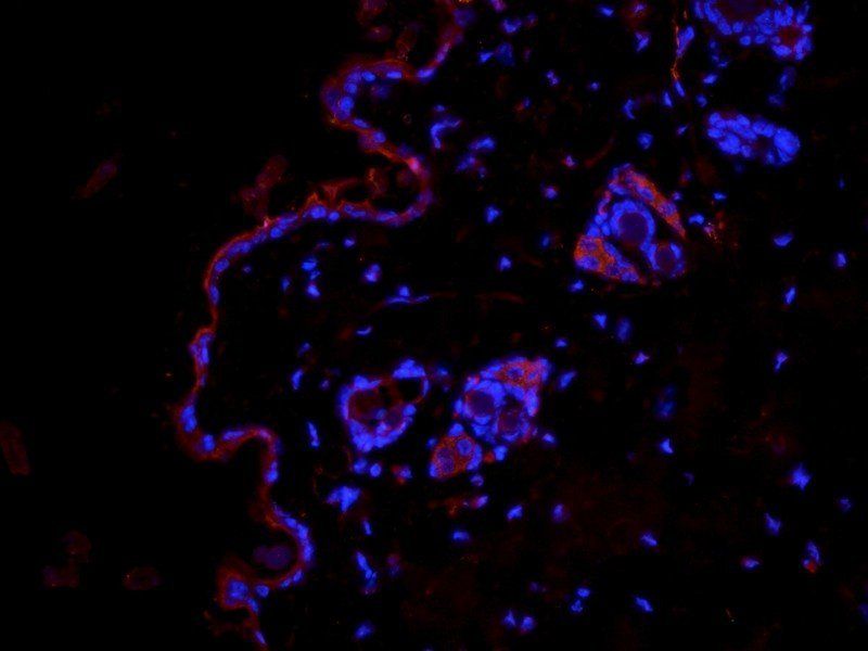 Fibrinopeptide B antibody