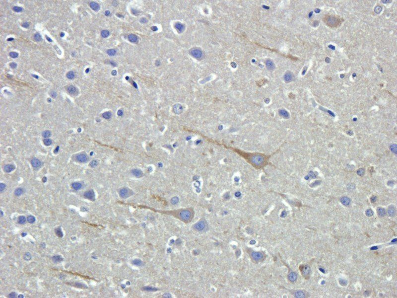 Fibrinopeptide B antibody