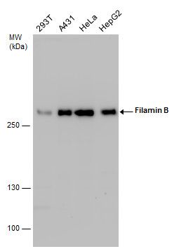 filamin B Antibody