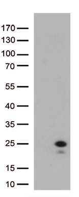 SH3PXD2A Antibody