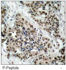 FKHR (Phospho-Ser256) Antibody