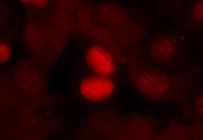 FKHR (Phospho-Ser256) Antibody