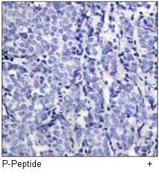 FKHR (Phospho-Ser319) Antibody