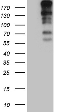 KLF11 Antibody