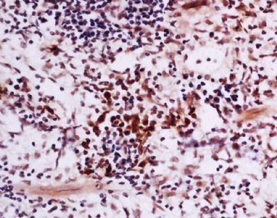 FKLF Rabbit Polyclonal Antibody