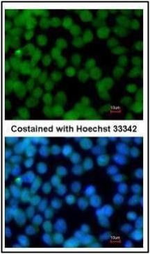 Flightless I Rabbit Polyclonal Antibody