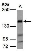 Flightless I Rabbit Polyclonal Antibody
