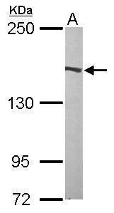 Flightless I Rabbit Polyclonal Antibody