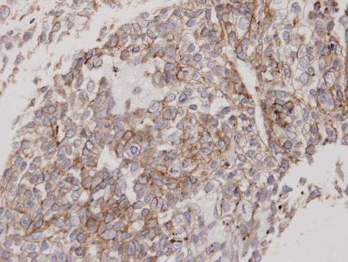 flotillin 2 Antibody