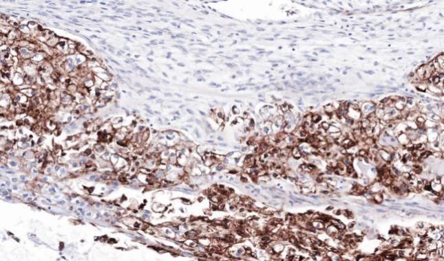 FLRT1 Rabbit Polyclonal Antibody