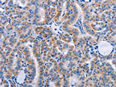 FN1 Antibody