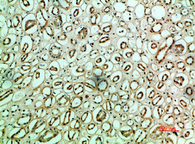 FN1 Antibody