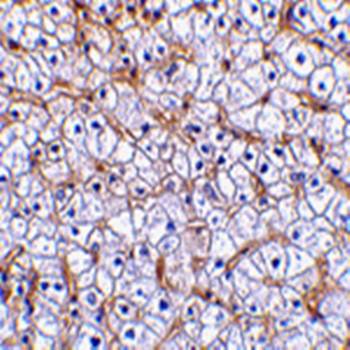 Fn14 Rabbit Polyclonal Antibody