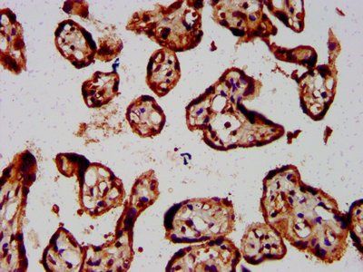 FOLR1 Antibody