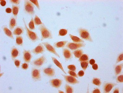HIST1H4A Antibody