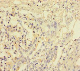 FOSL2 Antibody