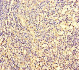 FOSL2 Antibody