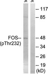 FOS (Phospho-Thr232) Antibody