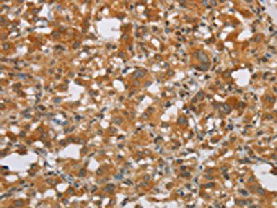 FOSB Antibody