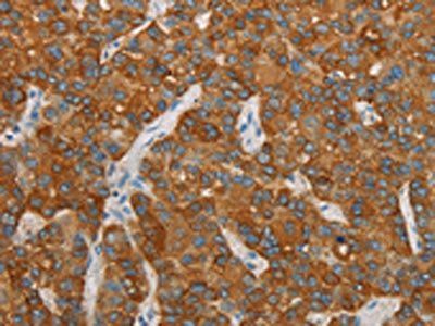 FOSB Antibody