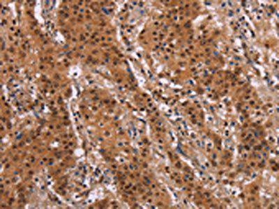 FOSL1 Antibody