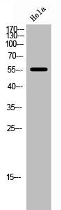 FOXC1/FOXC2 Antibody