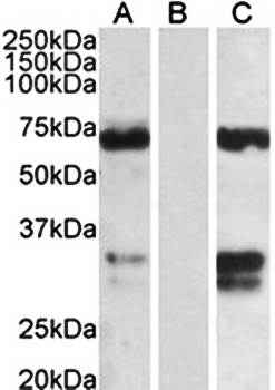 FOXC2 Antibody