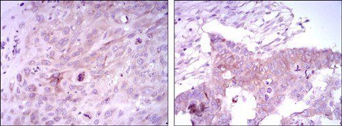 FOXD3 Antibody
