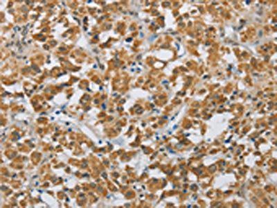 FOXF1 Antibody